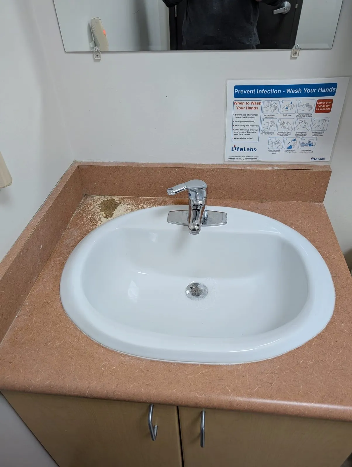 Old brown laminate bathroom vanity with chipped sink in a Vancouver building before replacement
